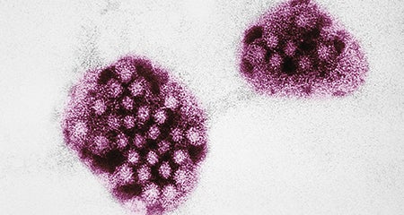 Norovirus Education Sheet